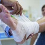 Bandażowanie nóg przy obrzęku limfatycznym